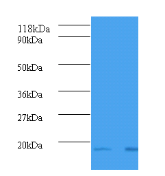 B2M Polyclonal Antibody