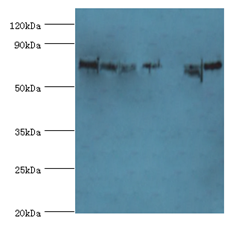 POR Polyclonal Antibody