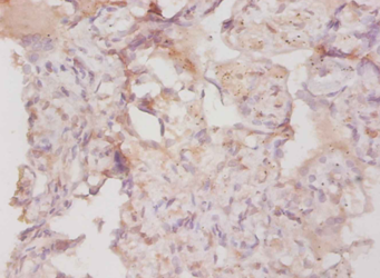 COL4A3 Polyclonal Antibody