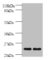 HLA-DPB1 Polyclonal Antibody (100 µl)