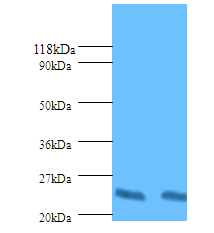 HLA-DPB1 Polyclonal Antibody