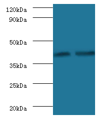 GLT8D2 Polyclonal Antibody