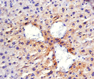 RBP4 Polyclonal Antibody