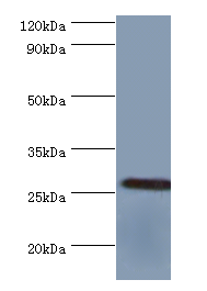 fre Polyclonal Antibody