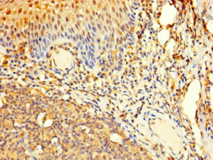 Immunohistochemistry of paraffin-embedded human tonsil tissue using AAR2 Polyclonal Antibody at dilution of 1:100