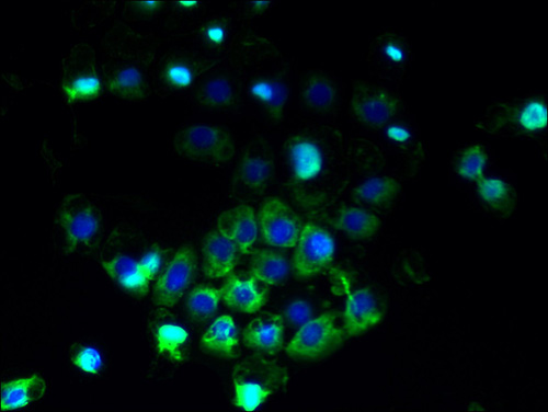 Immunofluorescent analysis of A431 cells using ABCB5 Polyclonal Antibody at a dilution of 1:100 and Alexa Fluor 488-congugated AffiniPure Goat Anti-Rabbit IgG(H+L)