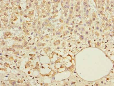Immunohistochemistry of paraffin-embedded human adrenal gland tissue using ABCF3 Polyclonal Antibody at dilution of 1:100