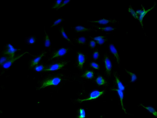 Immunofluorescent analysis of Hela cells using ABHD14A Polyclonal Antibody at a dilution of 1:100 and Alexa Fluor 488-congugated AffiniPure Goat Anti-Rabbit IgG(H+L)