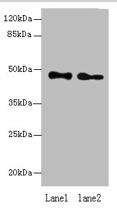 ABHD2 Polyclonal Antibody (100 µl)