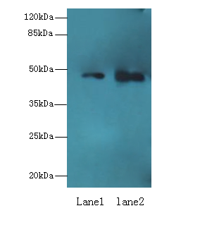 ABHD2 Polyclonal Antibody