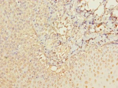 Immunohistochemistry of paraffin-embedded human tonsil tissue using ABI3 Polyclonal Antibody at dilution of 1:100