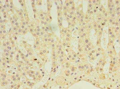 ABLIM3 Polyclonal Antibody (100 µl)