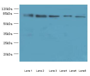 ACSBG2 Polyclonal Antibody (100 µl)