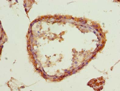 Immunohistochemistry of paraffin-embedded human testis tissue using ACSBG2 Polyclonal Antibody at dilution of 1:100