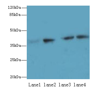 ACTL8 Polyclonal Antibody