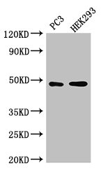 ACTR10 Polyclonal Antibody (100 µl)