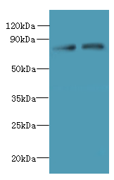 ACTR8 Polyclonal Antibody