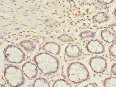 ACTRT1 Polyclonal Antibody