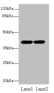 ACTRT2 Polyclonal Antibody (100 µl)