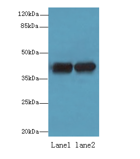 ACTRT2 Polyclonal Antibody