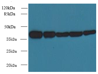 ACTRT3 Polyclonal Antibody (100 µl)