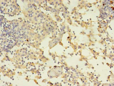 Immunohistochemistry of paraffin-embedded human thymus tissue at dilution of 1:100
