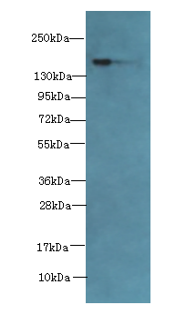 Western blot<br />All lanes: ADAMTS7 Polyclonal Antibody at 2ug/ml+Mouse brain tissue<br />Secondary<br />Goat polyclonal to rabbit at 1/10000 dilution<br />Predicted band size: 184kDa <br />Observed band size: 184kDa <br />