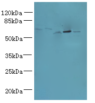 ADAT1 Polyclonal Antibody