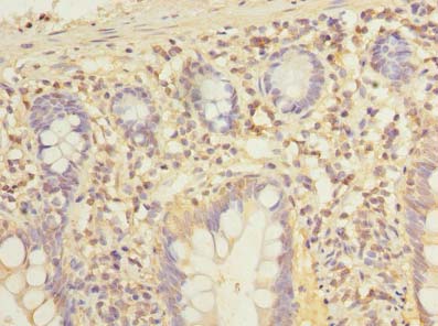 Immunohistochemistry of paraffin-embedded human small intestine tissue using ADGRL4 Polyclonal Antibody at dilution of 1:100