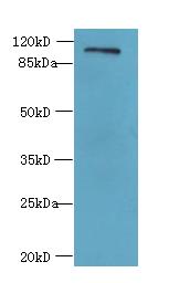 AGBL2 Polyclonal Antibody