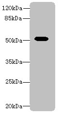 Aldh1a1 Polyclonal Antibody (50 µl)