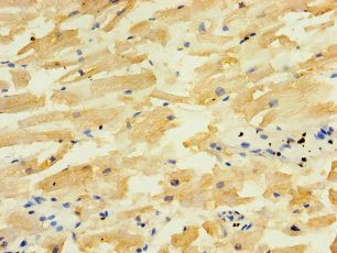 ALG5 Polyclonal Antibody