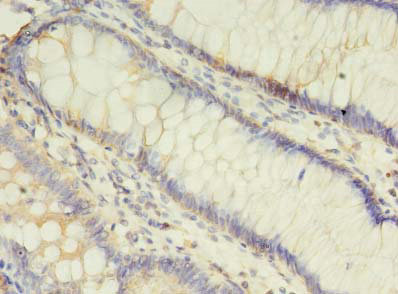 ALOX5 Polyclonal Antibody