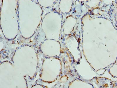 Immunohistochemistry of paraffin-embedded human thyroid tissue using ANKMY1 Polyclonal Antibody at dilution of 1:100