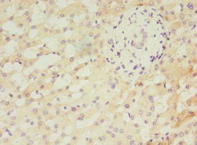 ANKMY2 Polyclonal Antibody