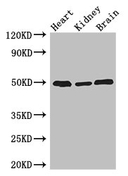 ANKRD10 Polyclonal Antibody