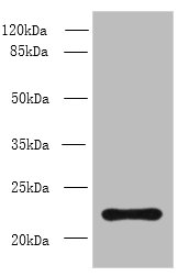 Western blot<br />All lanes: AP3S2 Polyclonal Antibody at 6ug/ml+ A549 whole cell lysate<br />Goat polyclonal to rabbit at 1/10000 dilution<br />Predicted band size: 23, 44 kDa<br />Observed band size: 22 kDa<br />