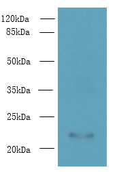 AP3S2 Polyclonal Antibody