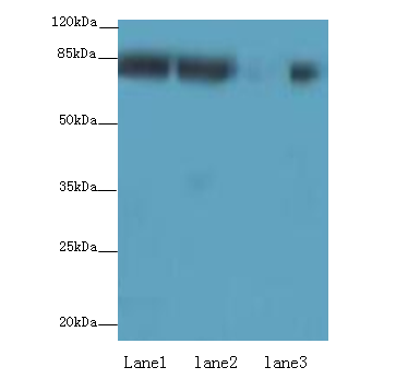 AP4B1 Polyclonal Antibody