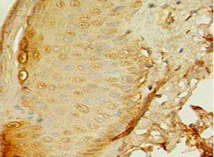 APAF1 Polyclonal Antibody