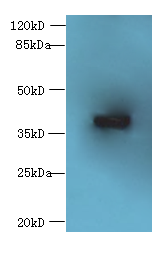 ARFIP2 Polyclonal Antibody