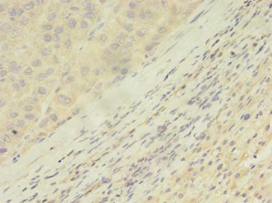 ARHGAP25 Polyclonal Antibody