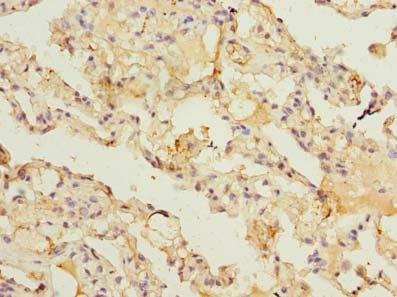ARL11 Polyclonal Antibody