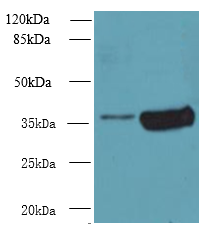 ARMC10 Polyclonal Antibody (100 µl)