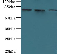 ARMC9 Polyclonal Antibody