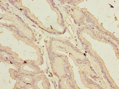 ARMCX1 Polyclonal Antibody