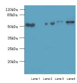 ARMCX2 Polyclonal Antibody (100 µl)