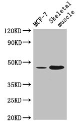 ARRDC3 Polyclonal Antibody