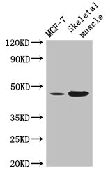 ARRDC3 Polyclonal Antibody (100 µl)