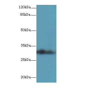 Western blot<br />All lanes: ASB8 Polyclonal Antibody at 1ug/ml+ Human placenta tissue<br />Goat polyclonal to rabbit at 1/10000 dilution<br />Predicted band size: 32 kDa <br />Observed band size: 32 kDa <br />